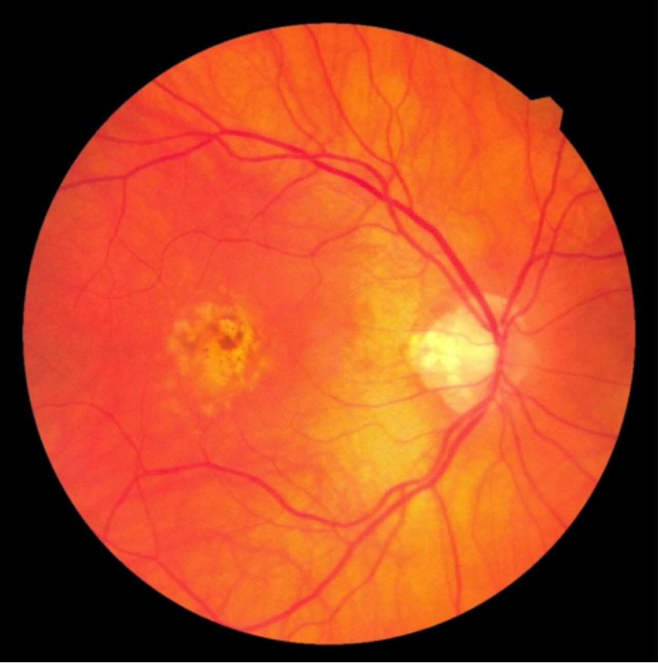 OCT and medical retina case studies Viewpoint