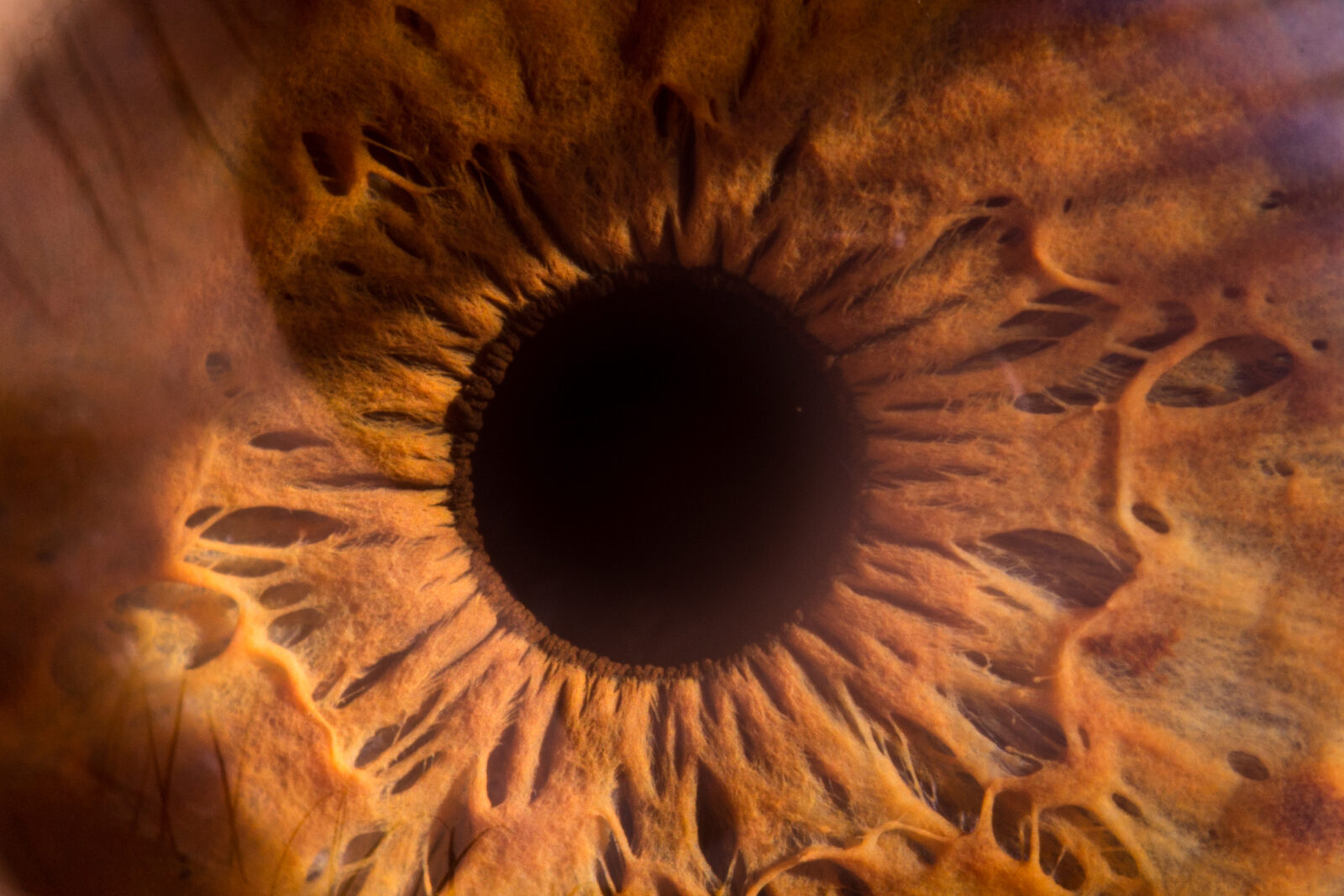 30 Most Common Pathological Conditions Of The Eye Viewpoint 30-most-common-pathological-conditions-of-the-eye-viewpoint